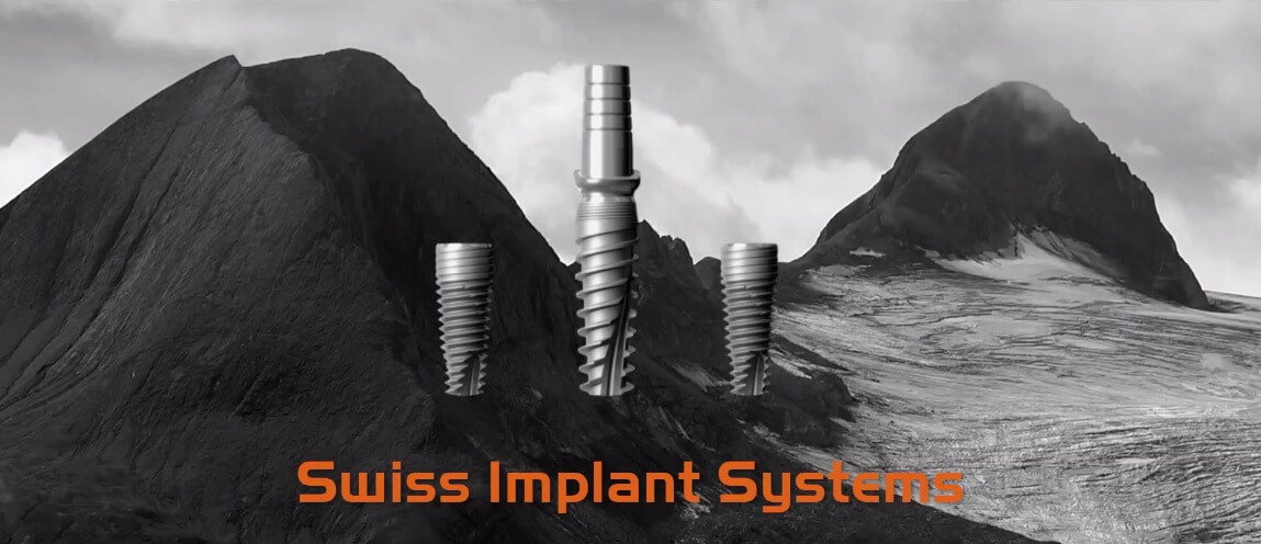 Zahnimplantat - Swiss Implant Systems