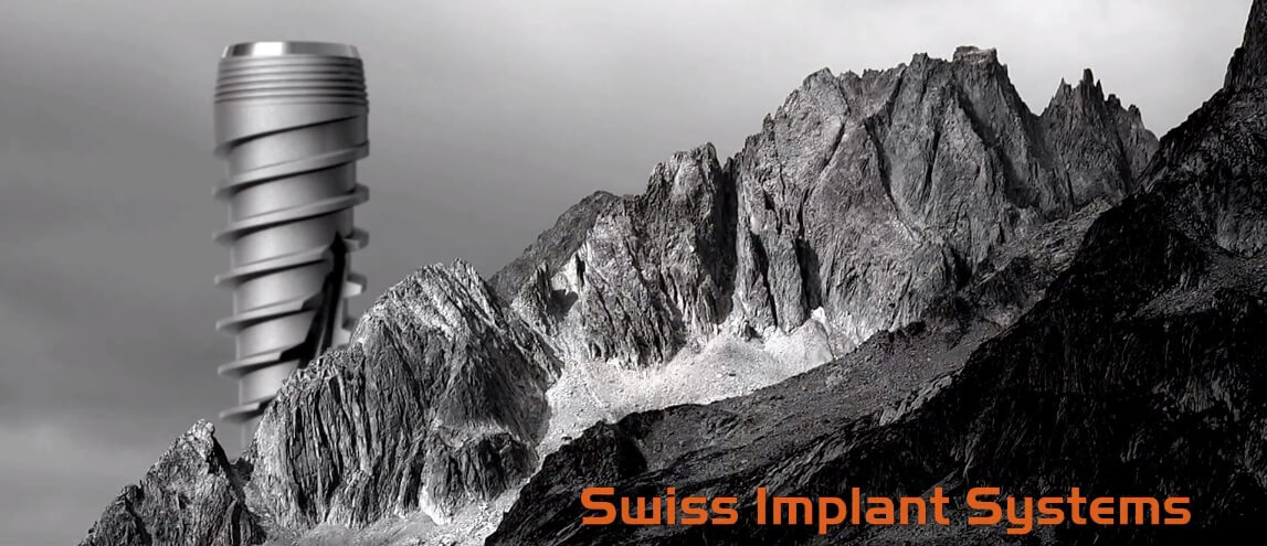 Zahnimplantat - Swiss Implant Systems